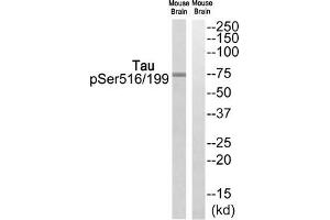 Western blot analysis of extracts from Mouse brain cells, using Tau (Phospho-Ser516/199) antibody. (MAPT Antikörper  (pSer199, pSer516))