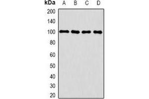 Western blot analysis of CLCN5 expression in HepG2 (A), THP1 (B), mouse kidney (C), mouse brain (D) whole cell lysates. (Chloride Channel 5 Antikörper)