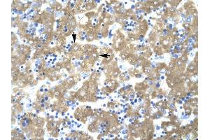ACAT2 antibody was used for immunohistochemistry at a concentration of 4-8 ug/ml to stain Hepatocytes (arrows) in Human liver. (ACAT2 Antikörper)