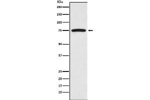 Western blot analysis of FRS2 expression in HeLa cell lysate.