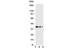 Western blot testing of Wnt2B antibody and human recombinant protein, 36KD with tag;  Lane 1: 10ng;  2.