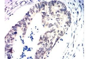 Immunohistochemistry (IHC) image for anti-TAR DNA Binding Protein (TARDBP) antibody (ABIN7193979)