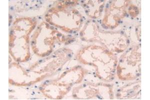 Detection of IL4 in Human Kidney Tissue using Polyclonal Antibody to Interleukin 4 (IL4)