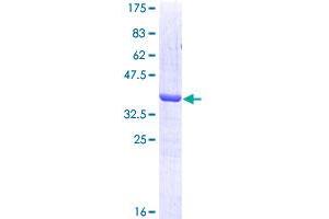 Image no. 1 for GTPase Kras (KRAS) (AA 16-125) protein (GST tag) (ABIN1308935)