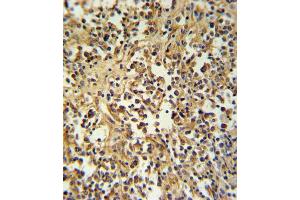 GZ Antibody (Center) (ABIN390763 and ABIN2841021) IHC analysis in formalin fixed and paraffin embedded human lymph tissue followed by peroxidase conjugation of the secondary antibody and DAB staining. (GZMM Antikörper  (AA 84-113))