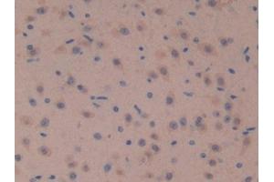 Detection of SOSTDC1 in Mouse Brain Tissue using Polyclonal Antibody to Sclerostin Domain Containing Protein 1 (SOSTDC1) (SOSTDC1 Antikörper  (AA 24-206))