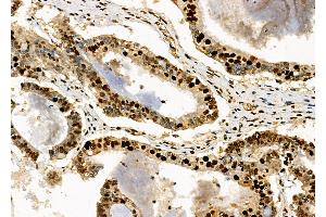 anti-Necdin-Like 2 (NDNL2) (Internal Region) antibody
