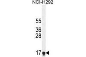 Western Blotting (WB) image for anti-Hepatocellular Carcinoma, Down-Regulated 1 (HEPN1) antibody (ABIN2995879) (HEPN1 Antikörper)