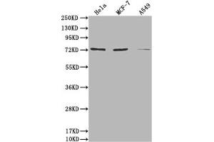 Western Blot Positive WB detected in: Hela whole cell lysate, MCF-7 whole cell lysate, A549 whole cell lysate All lanes: SAMHD1 antibody at 1:2000 Secondary Goat polyclonal to rabbit IgG at 1/50000 dilution Predicted band size: 73, 64, 69 kDa Observed band size: 73 kDa (SAMHD1 Antikörper  (AA 1-314))