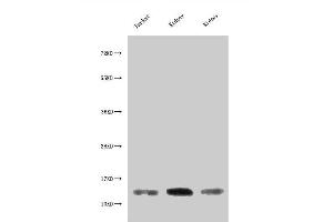Western Blot Positive WB detected in: Jurkat whole cell lysate, Rat kidney tissue, Mouse kidney tissue All lanes: MIF antibody at 3 μg/mL Secondary Goat polyclonal to rabbit IgG at 1/50000 dilution Predicted band size: 13 kDa Observed band size: 13 kDa (MIF Antikörper  (AA 2-115))