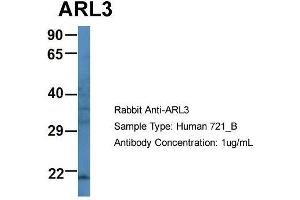 Host: Rabbit Target Name: ARL3 Sample Type: Human 721_B Antibody Dilution: 1.