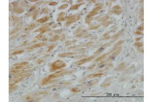 Image no. 5 for anti-Hedgehog Interacting Protein (HHIP) (AA 21-121) antibody (ABIN466235) (HHIP Antikörper  (AA 21-121))