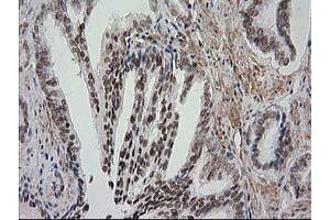 Image no. 7 for anti-Nicotinamide N-Methyltransferase (NNMT) antibody (ABIN1499790)