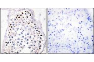 Immunohistochemistry analysis of paraffin-embedded human testis tissue, using HOXA1/B1/D1 Antibody. (HOXA1/B1/D1 Antikörper  (AA 216-265))