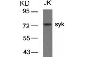 Image no. 3 for anti-Spleen tyrosine Kinase (SYK) (AA 321-325) antibody (ABIN319415)