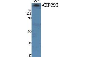 Western Blotting (WB) image for anti-Centrosomal Protein 290kDa (CEP290) (Internal Region) antibody (ABIN3174343) (CEP290 Antikörper  (Internal Region))