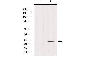 Western blot analysis of extracts from Hela, using RPS5 Antibody. (RPS5 Antikörper  (Internal Region))