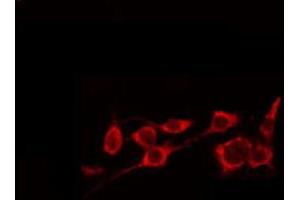 ABIN6274913 staining NIH-3T3 by IF/ICC. (GLB1 Antikörper  (Internal Region))