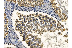 ABIN6264324 and ABIN6272396 at 1/100 staining rat testis tissue by IHC-P. (PNPT1 Antikörper  (C-Term))