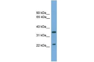 WB Suggested Anti-WIF1 Antibody Titration: 0. (WIF1 Antikörper  (N-Term))
