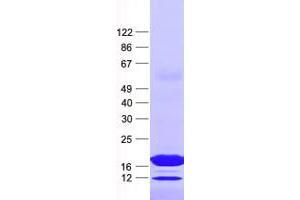 Validation with Western Blot