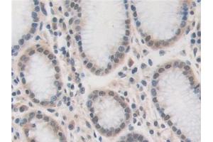 Immunohistochemistry (IHC) image for anti-Ubiquitin Specific Peptidase 7 (Herpes Virus-Associated) (USP7) (AA 54-507) antibody (ABIN7443551)