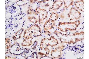 Immunohistochemistry (Paraffin-embedded Sections) (IHC (p)) image for anti-Solute Carrier Family 4, Sodium Borate Transporter, Member 11 (SLC4A11) antibody (ABIN5911132)