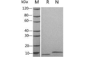 2 μg of EGF, Human  was resolved with SDS-PAGE under reducing (R) and non-reducing (N) conditions and visualized by Coomassie Blue staining. (EGF Protein)