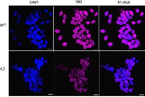 Immunocytochemical staining of HeLa cells using QKI antibody (ABIN7800036), 1:1,000), Top panel: wild-type (WT), Bottom panal: QKI shRNA knockdown (KD).