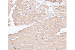 Immunohistochemistry of paraffin-embedded Rat heart using ABCC5 Polyclonal Antibody at dilution of 1:100 (40x lens).