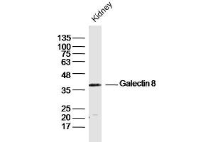 Mouse Kidney lysates probed with Galectin 8 Polyclonal Antibody, Unconjugated  at 1:300 dilution and 4˚C overnight incubation. (LGALS8 Antikörper  (AA 281-359))
