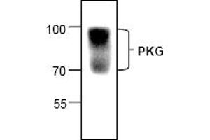 Image no. 1 for anti-Protein Kinase, CGMP-Dependent, Type I (PRKG1) (N-Term) antibody (ABIN127130) (PRKG1 Antikörper  (N-Term))