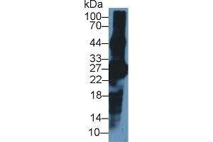 CRYBA1 Antikörper  (AA 1-215)