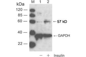 Western blot analysisLane 1: cell lysate of NIH/3T3 unstimulatedLane 2: cell lysate of NIH/3T3 stimulated with insulinPrimary Antibody: Rabbit Anti-Akt (Phospho-Ser473) Polyclonal Antibody (ABIN398632) Secondary Antibody: 0. (AKT1 Antikörper  (pSer473))