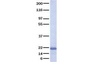 Validation with Western Blot (FGF10 Protein)