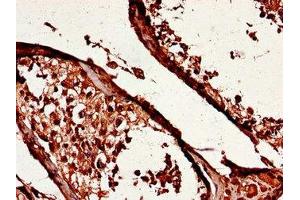 Immunohistochemistry of paraffin-embedded human testis tissue using ABIN7174080 at dilution of 1:100 (YES1 Antikörper  (AA 1-155))