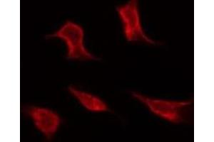 ABIN6267292 staining MDA-MB-435 by IF/ICC. (p53 Antikörper  (pSer366))