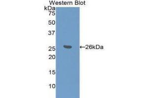 Western Blotting (WB) image for anti-BH3 Interacting Domain Death Agonist (BID) (AA 1-195) antibody (ABIN1077861)