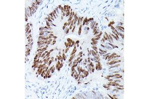 Immunohistochemistry of paraffin-embedded rat lung using GAPDH Mouse mAb (ABIN3020540, ABIN3020541, ABIN3020542 and ABIN1512934) at dilution of 1:100 (40x lens). (GAPDH Antikörper)