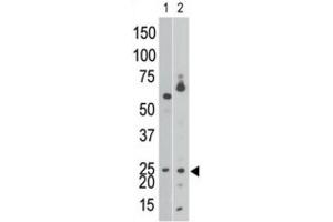 Western Blotting (WB) image for anti-BCL2/adenovirus E1B 19kDa Interacting Protein 3 (BNIP3) (BH3 Domain) antibody (ABIN2997216) (BNIP3 Antikörper  (BH3 Domain))