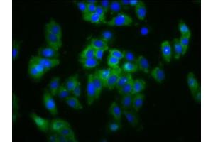 Immunofluorescence staining of HepG2 cells with ABIN7170267 at 1:133, counter-stained with DAPI. (SLC5A4 Antikörper  (AA 579-633))