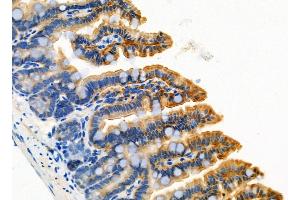ABIN6261648 and ABIN6276771 at 1/100 staining Mouse colorectal tissue by IHC-P.