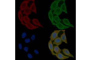 ABIN6265688 and ABIN6278646 staining Hela cells(30 min of UV treatment) by IF/ICC. (Tryptophan Hydroxylase 2 Antikörper  (N-Term))