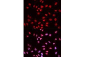 Immunofluorescence (IF) image for anti-ELK1, Member of ETS Oncogene Family (ELK1) (pSer383) antibody (ABIN1870156) (ELK1 Antikörper  (pSer383))