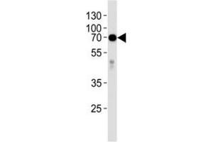 Western blot analysis of lysate from human placenta tissue lysate using anti-Alkaline Phosphatase antibody diluted at 1:1000. (Alkaline Phosphatase Antikörper  (AA 274-304))