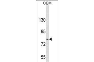 TGFBR Antibody (C-term) 3395b western blot analysis in CEM cell line lysates (35 μg/lane).