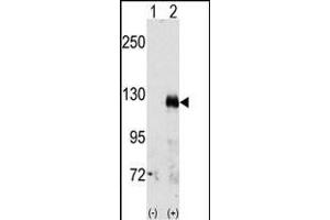 Western blot analysis of EphA3(arrow) using rabbit polyclonal EphA3 Antibody (C-term) (ABIN391888 and ABIN2841708). (EPH Receptor A3 Antikörper  (C-Term))