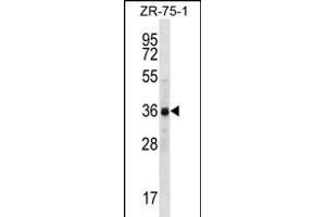 CCNYL2 Antibody (Center) (ABIN656247 and ABIN2845564) western blot analysis in ZR-75-1 cell line lysates (35 μg/lane). (CCNYL2 Antikörper  (AA 162-191))