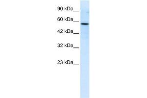 WB Suggested Anti-RIPX Antibody Titration:  0. (RUFY3 Antikörper  (C-Term))