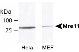 Image no. 1 for anti-MRE11 Meiotic Recombination 11 Homolog A (S. Cerevisiae) (MRE11A) antibody (ABIN363310) (Mre11 Antikörper)